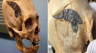 Archaeologists Stunned As 2,000-Year-Old Skull Bound By Metal Evidence Of Ancient Surgery