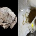 Archaeologists Just Found A 5,300-Year-Old Skull With Evidence Of The Earliest Known Ear Surgery